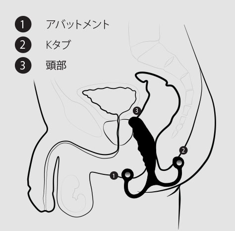 PSYの大き目なアバットメントとKタブが下半身を効率よく刺激します。